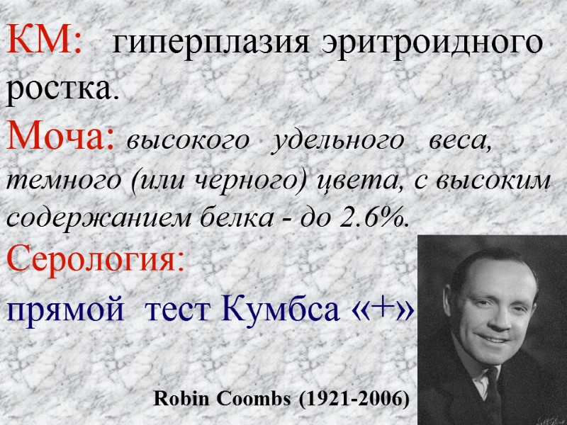 КМ:   гиперплазия эритроидного ростка. Моча: высокого   удельного   веса,